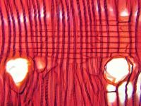 Radial section
